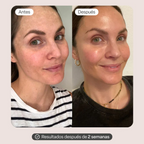 Tratamiento Full: 3 Meses